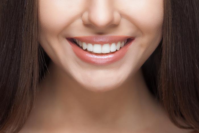 Tips To Care For Your Veneers. 